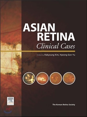Asian Retina