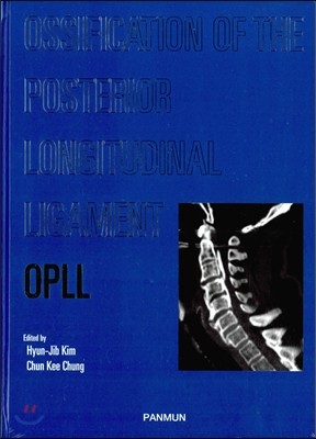 OPLL Ossification of the Posterior Longitudinal Ligament