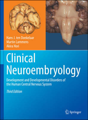 Clinical Neuroembryology: Development and Developmental Disorders of the Human Central Nervous System