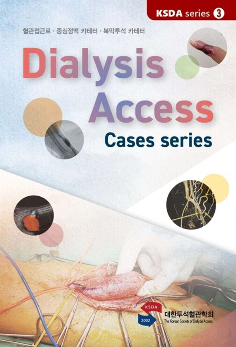 Dialysis Access - Case series