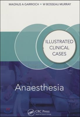 Anaesthesia