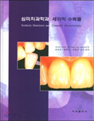 심미치과학과 세라믹 수복물