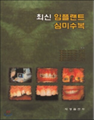 최신 임플랜트 심미수복
