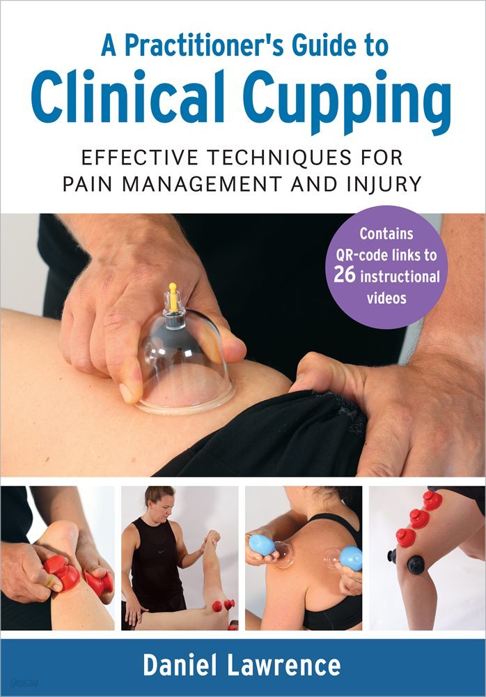 A Practitioner&#39;s Guide to Clinical Cupping