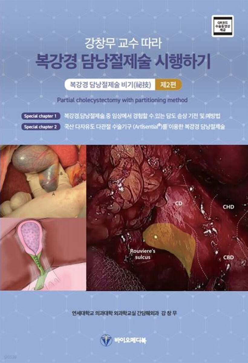 강창무 교수 따라 복강경 담낭절제술 시행하기 제2편