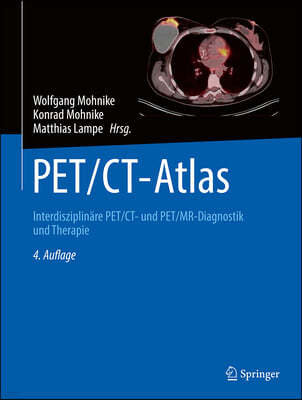 Pet/Ct-Atlas: Interdisziplinäre Pet/Ct- Und Pet/Mr-Diagnostik Und Therapie