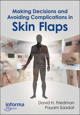 Making Decisions and Avoiding Complications in Skin Flaps