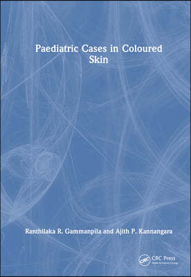 Paediatric Cases in Coloured Skin