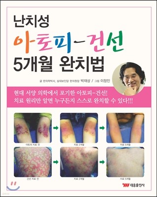 난치성 아토피 건선 5개월 완치법