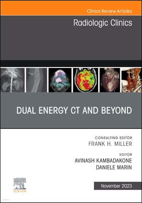Dual Energy CT and Beyond, an Issue of Radiologic Clinics of North America: Volume 61-6