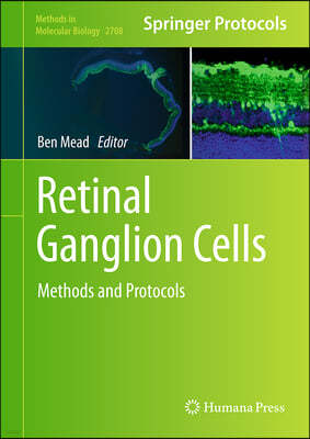 Retinal Ganglion Cells: Methods and Protocols