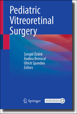 Pediatric Viteoretinal Surgery