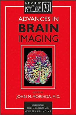 Advances in Brain Imaging