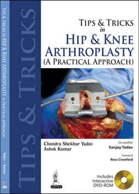 Tips and Tricks in Hip and Knee Arthroplasty: (A Practical Approach)