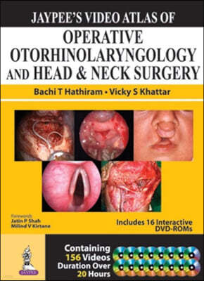 Jaypee's Video Atlas of Operative Otorhinolaryngology and Head & Neck Surgery