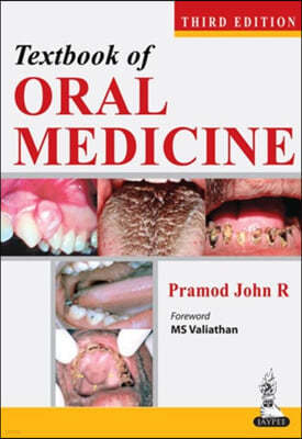 Textbook of Oral Medicine