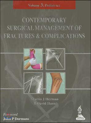 Contemporary Surgical Management of Fractures and Complications: Volume 3 - Pediatrics