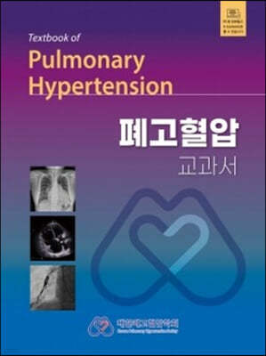   Textbook of Pulmonary Hypertension