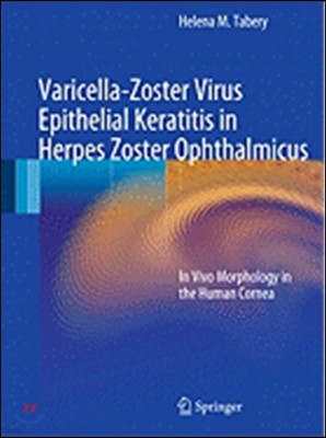 Varicella-Zoster Virus Epithelial Keratitis in Herpes Zoster Ophthalmicus