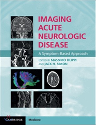 Imaging Acute Neurologic Disease: A Symptom-Based Approach