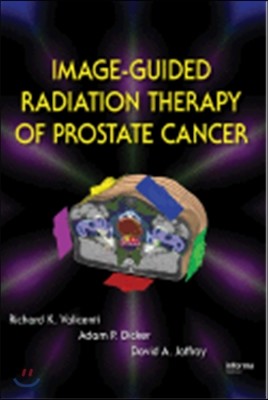 Image-Guided Radiation Therapy of Prostate Cancer