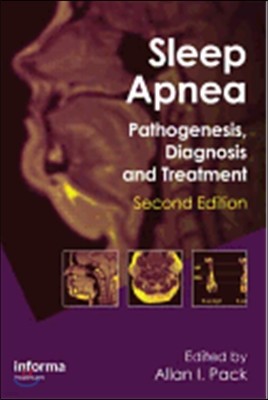 Sleep Apnea: Pathogenesis, Diagnosis and Treatment
