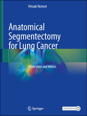 Anatomical Segmentectomy for Lung Cancer: Illustration and Videos