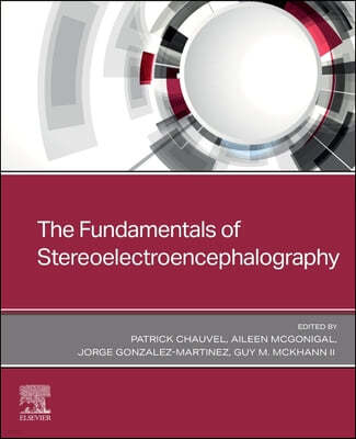 The Fundamentals of Stereoelectroencephalography