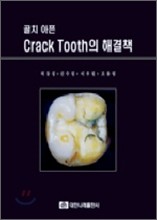 ġ  Crack Tooth ذå