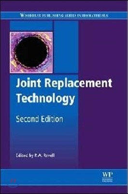 Joint Replacement Technology