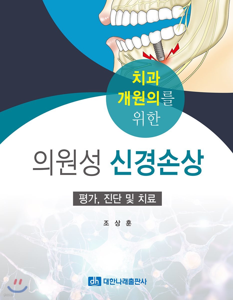 치과 개원의를 위한 의원성 신경손상