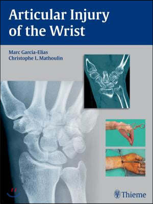 Articular Injury of the Wrist: Fessh 2014 Instructional Course Book