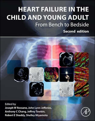 Heart Failure in the Child and Young Adult: From Bench to Bedside