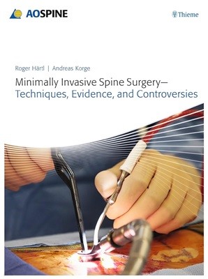 Minimally Invasive Spine Surgery : Techniques, Evidence, and Controversies (ISBN : 9783131723819)