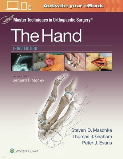 The Hand, 3/ed