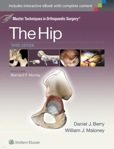 The Hip, 3/ed