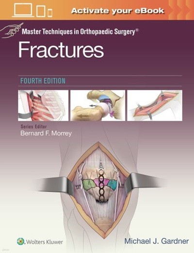 Fractures, 4/ed (Master Techniques in Orthopaedic Surgery) (ISBN : 9781975139407)