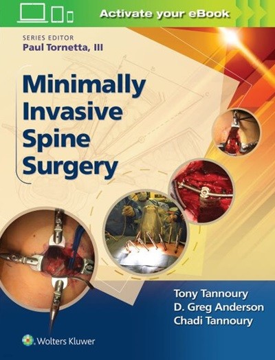 Minimally Invasive Spine Surgery (ISBN : 9781496301321)