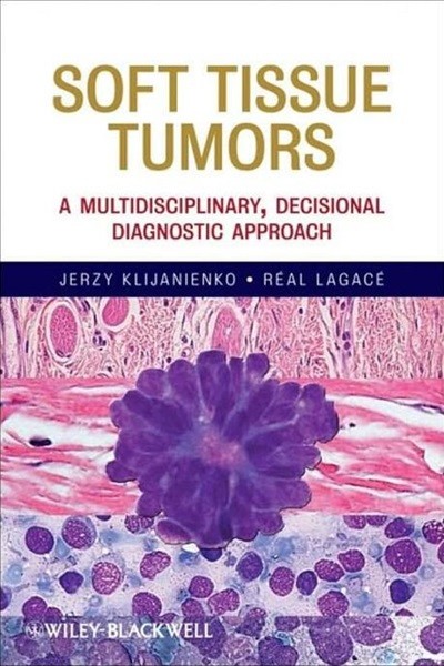 Soft Tissue Tumors : A Multidisciplinary, Decisional Diagnostic Approach (ISBN : 9780470505717)