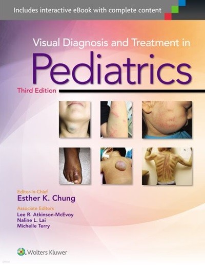 Visual Diagnosis and Treatment in Pediatrics, 3/ed (ISBN : 9781451191189)