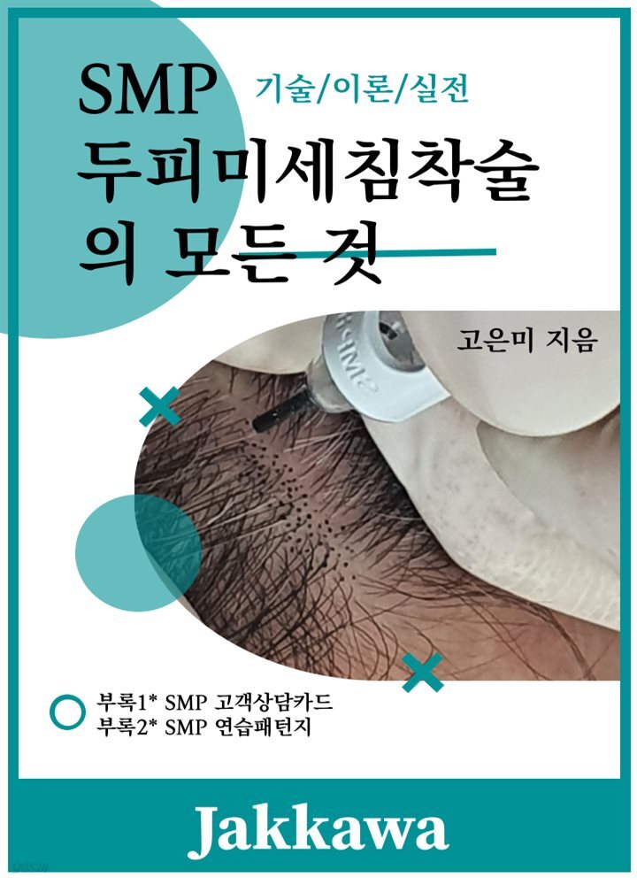 SMP 두피미세침착술의 모든 것