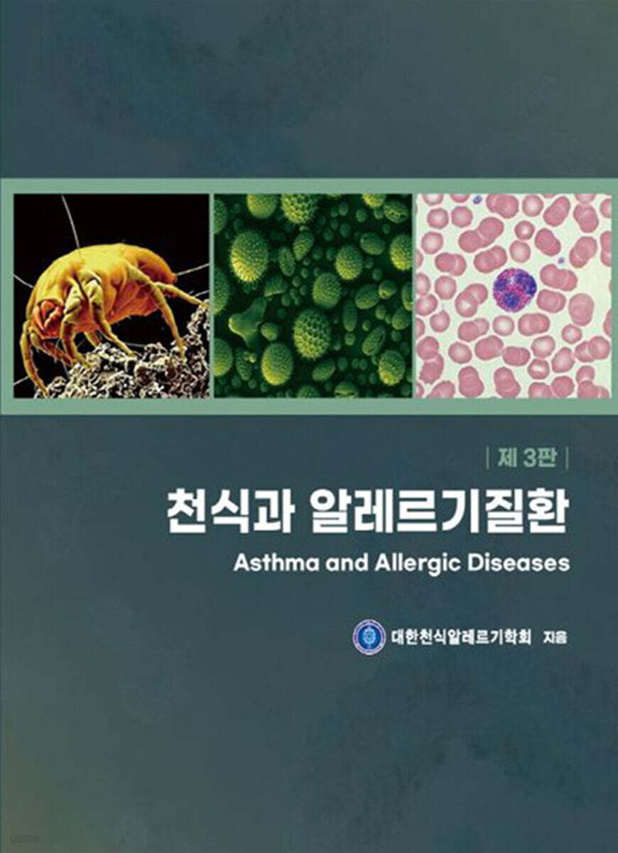 천식과 알레르기 질환