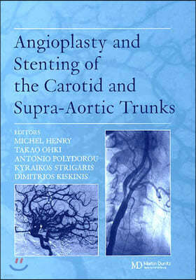 Angioplasty and Stenting of Carotid and Supra-Aortic Trunks