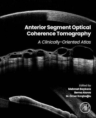 Anterior Segment Optical Coherence Tomography: A Clinically-Oriented Atlas
