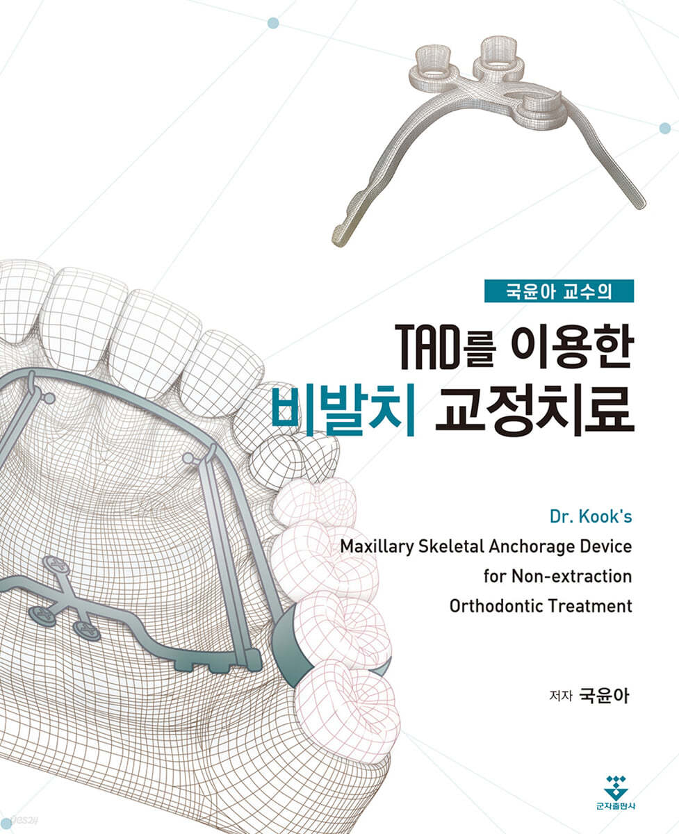 국윤아 교수의 TAD를 이용한 비발치 교정치료