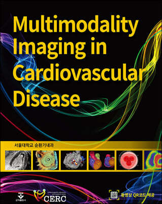 Multimodality imaging in cardiovascular diseases