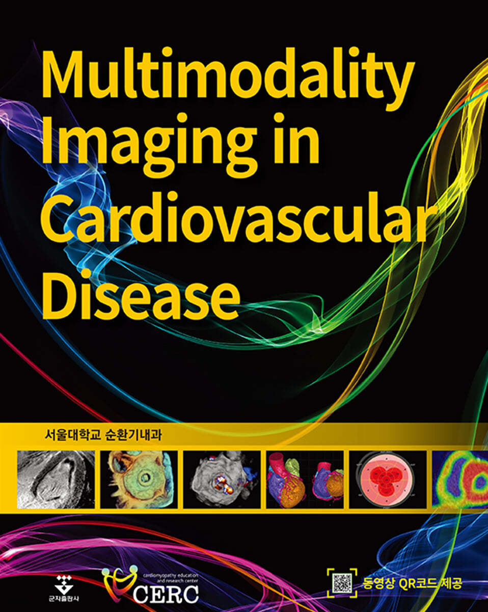 Multimodality imaging in cardiovascular diseases