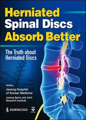 Herniated Spinal Discs Absorb Better