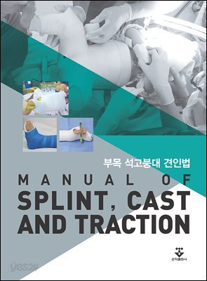 부목 석고붕대 견인법