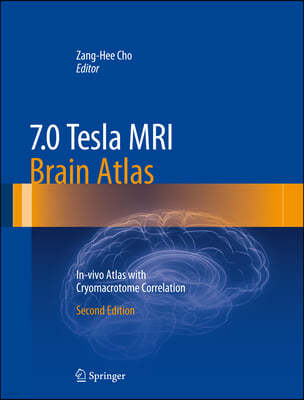 7.0 Tesla MRI Brain Atlas: In-Vivo Atlas with Cryomacrotome Correlation